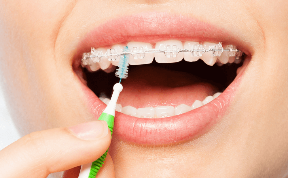 Cepillo interdental